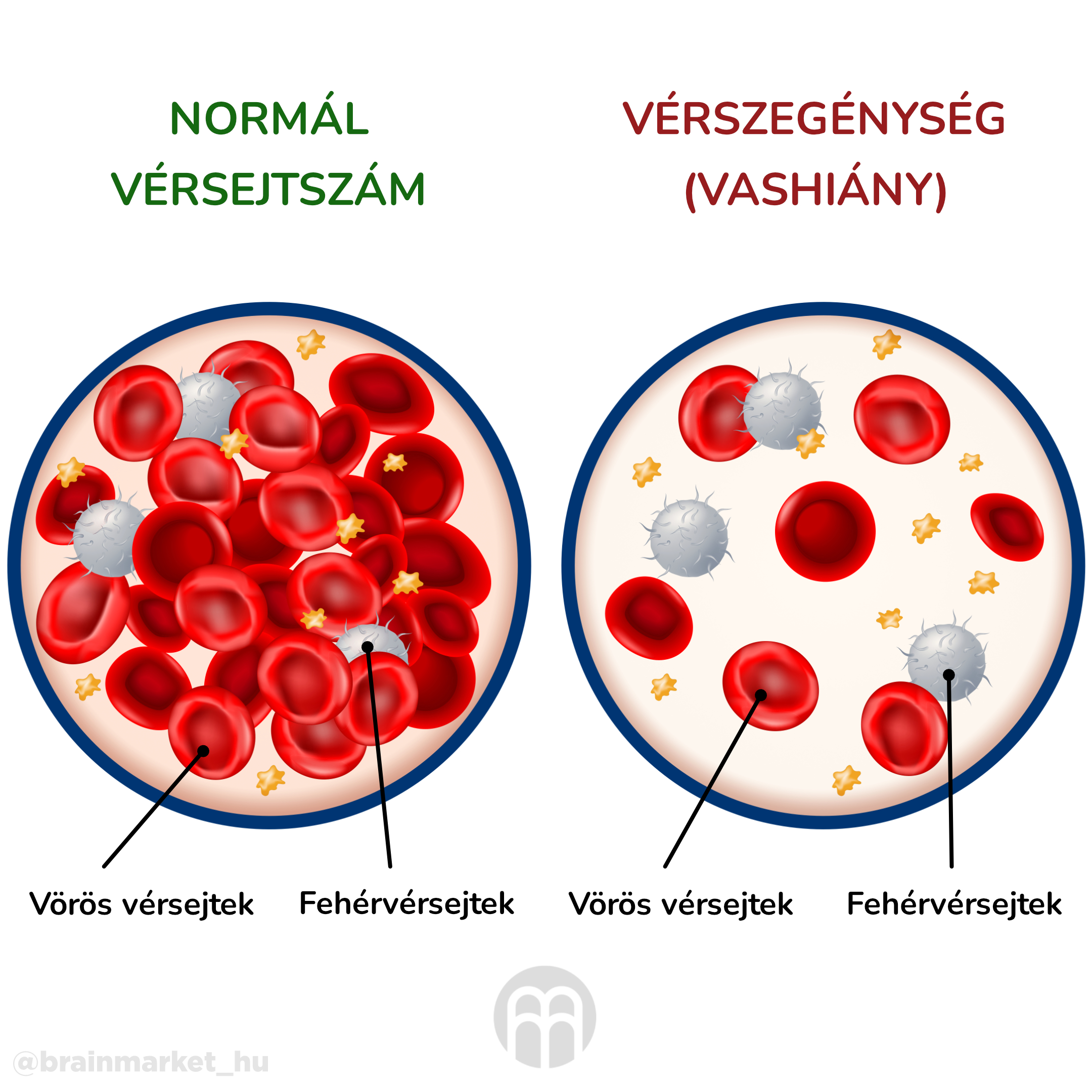 anemie_infografika_hu