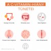 nedostatek vitaminu C infografika hu