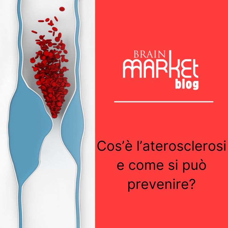 Cos'è l'aterosclerosi e come si può prevenire?