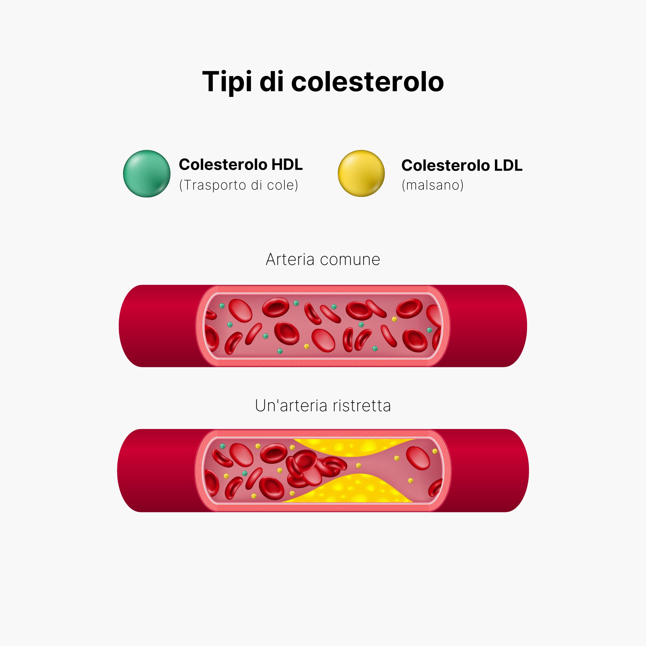(Italština) Typy cholesterolu