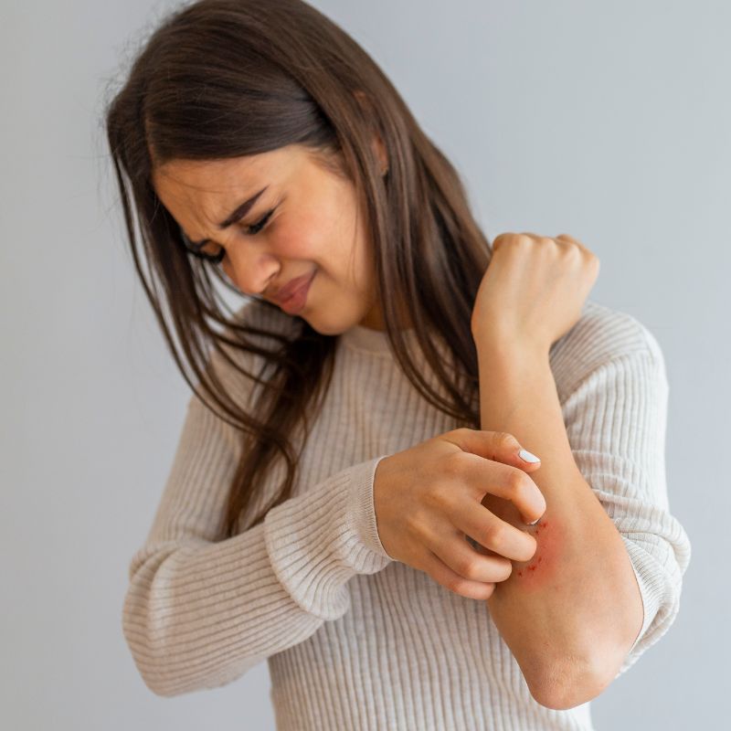 Nietolerancja histaminy i mikrobiom: Jak złagodzić objawy i poprawić zdrowie jelit!