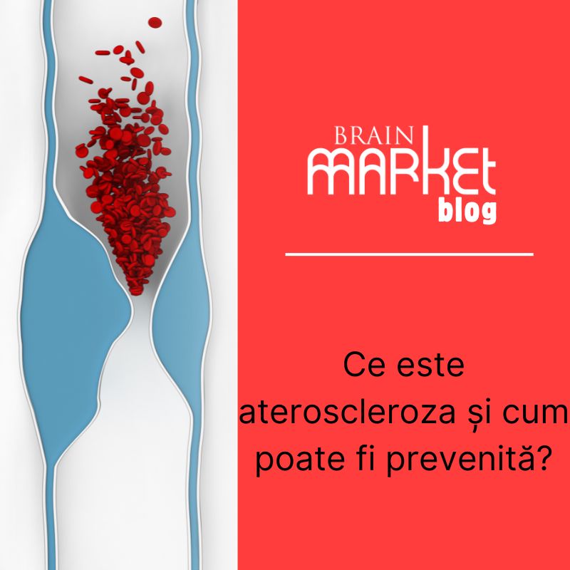Ce este ateroscleroza și cum poate fi prevenită?
