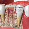 dentin infografika zuby brainmarket CZ