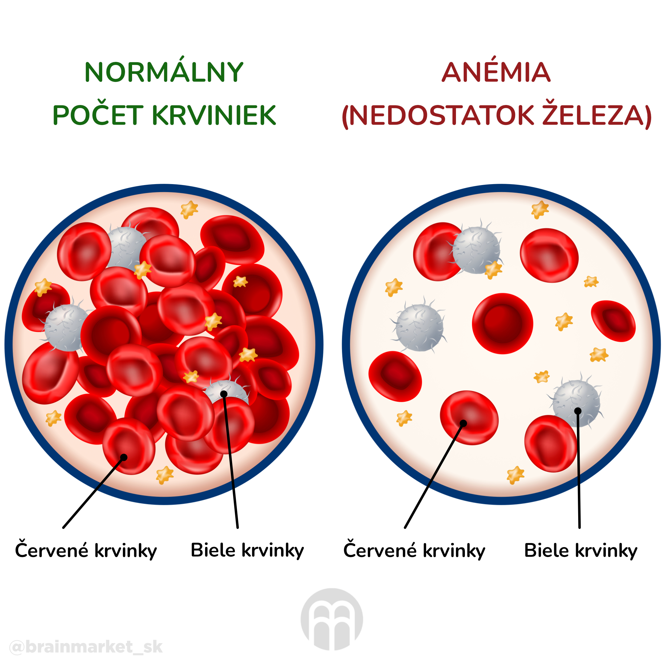 anemie_infografika_cz