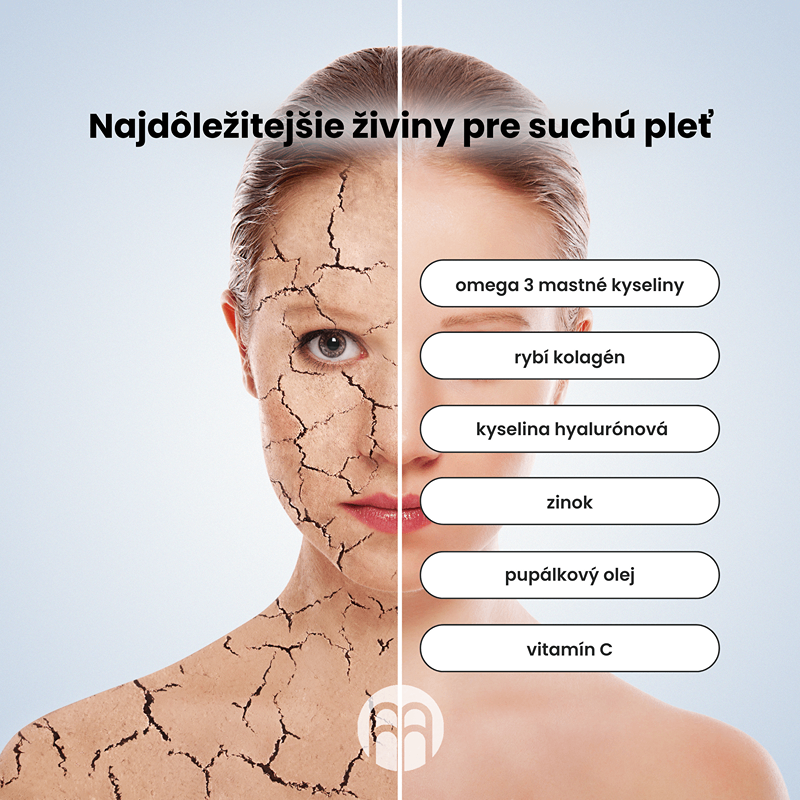 Suchá pokožka nielen v zime: príčiny a riešenie extrémne suchej pokožky.