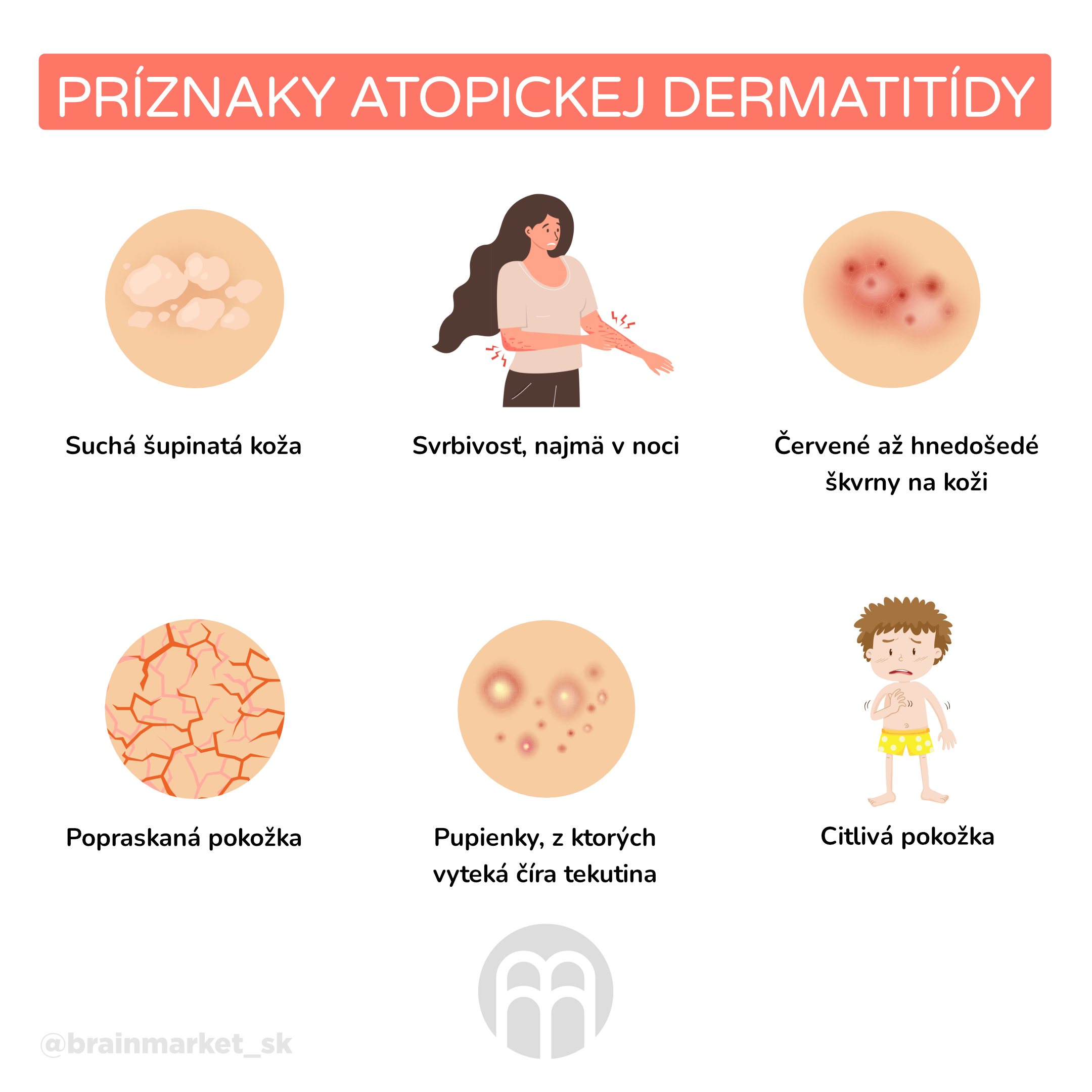 Atopická dermatitída - ako účinne riešiť problémy s ekzémami