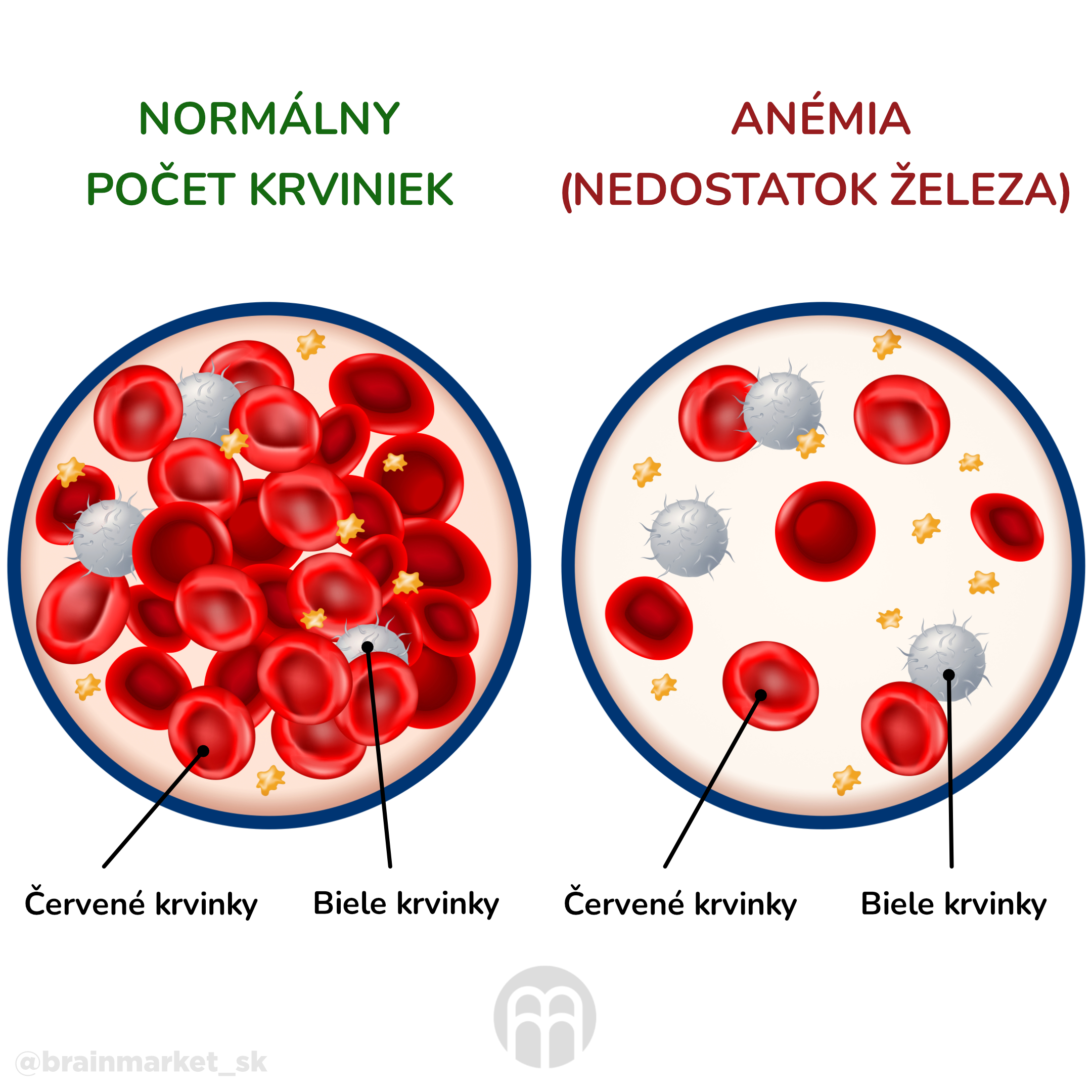 anemie_infografika_cz