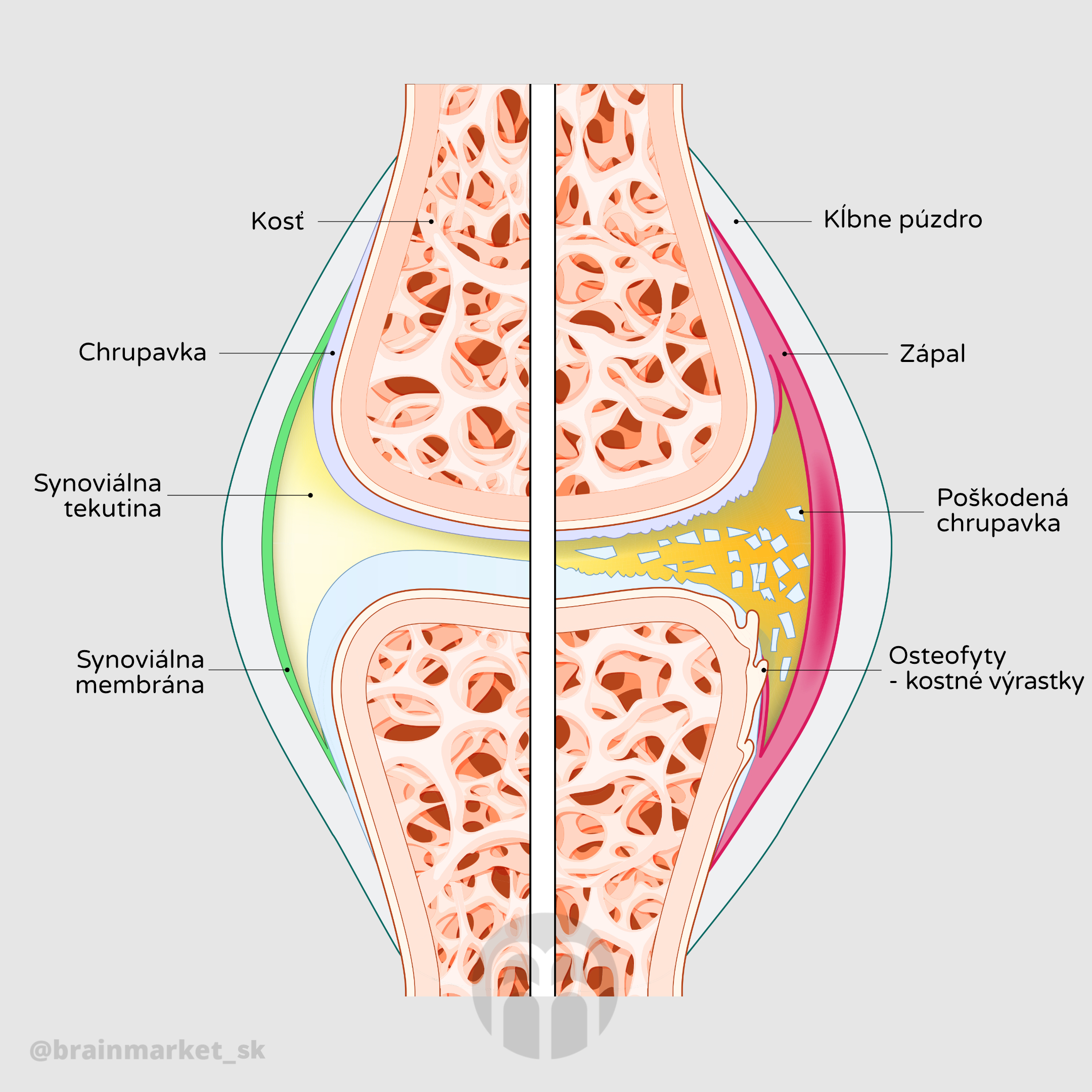 kloub_infografika_Cz