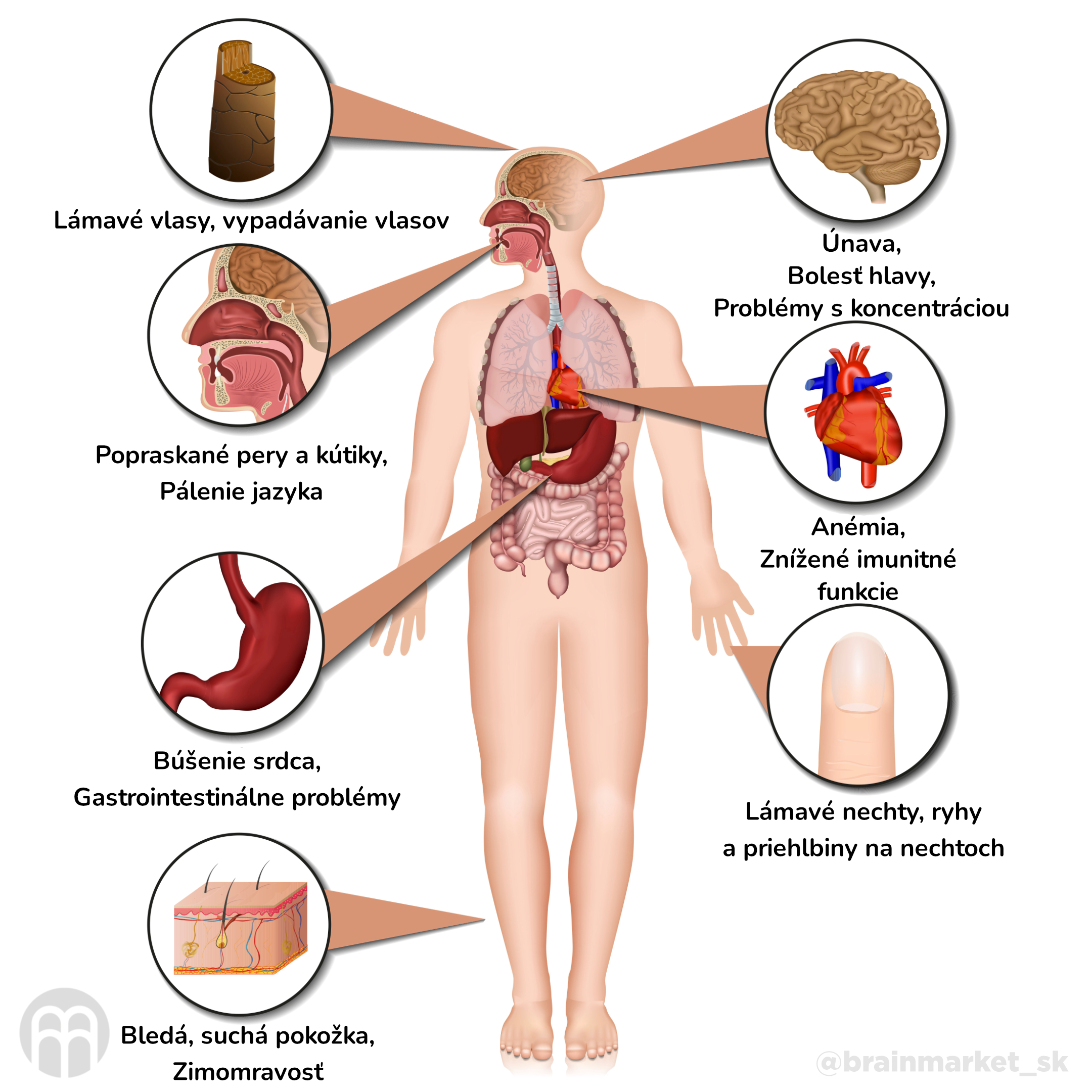 nedostatek zeleza_infografika_cz