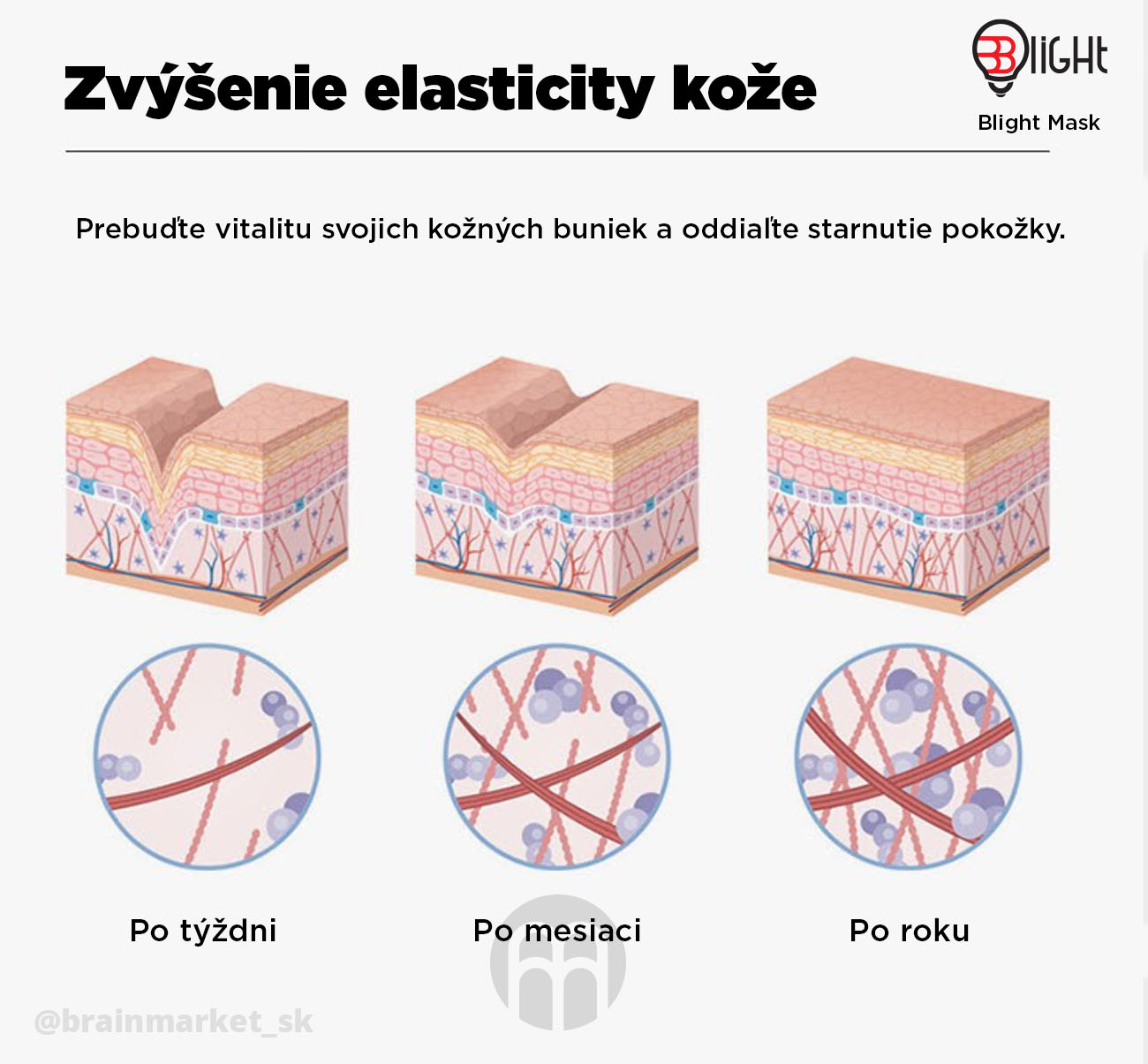 zvysenie-elasticity-koze-infografika-brainmarket-sk