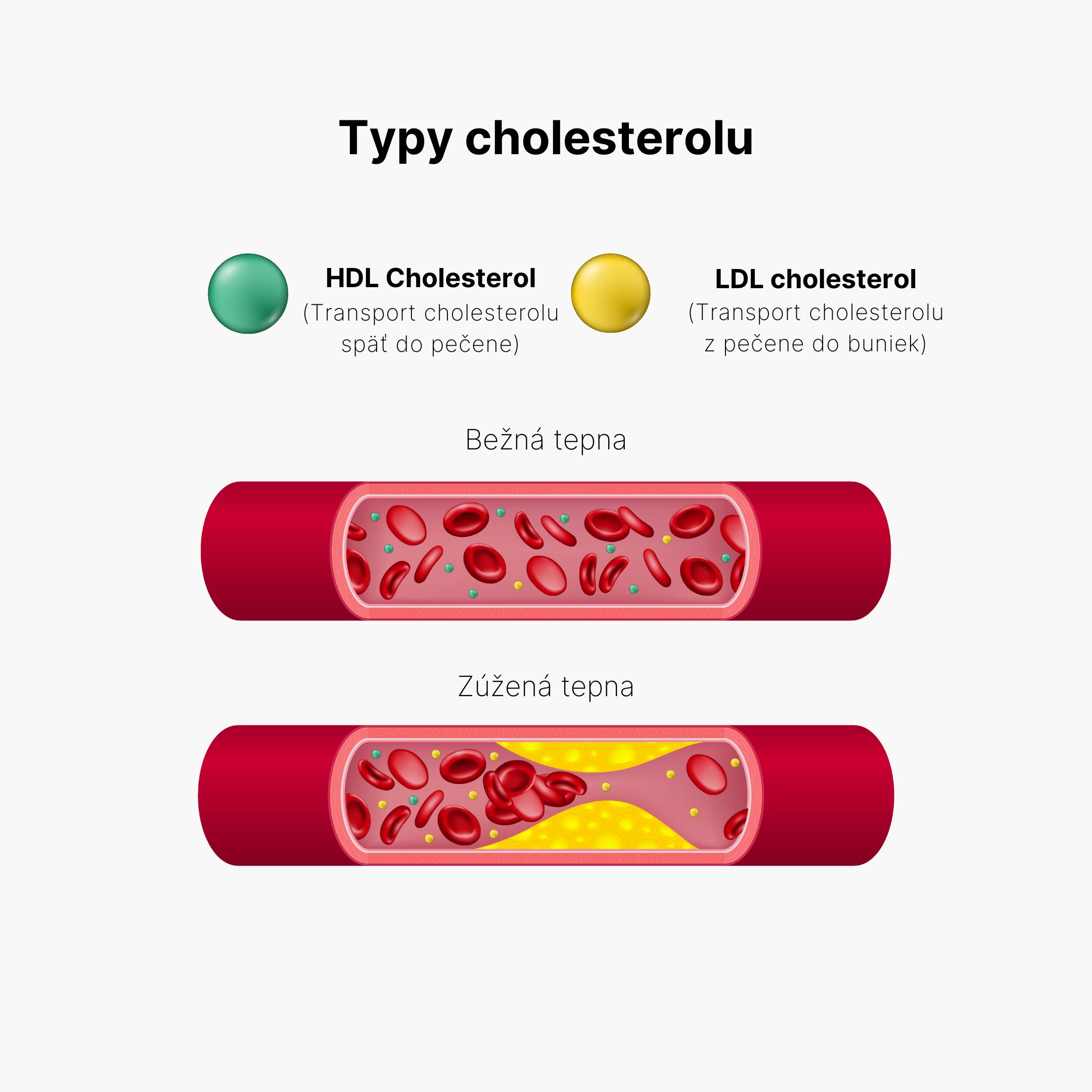 BrainMax Cholesterol Support, Řešení Cholesterolu, 100 rostlinných kapslí Obrázek