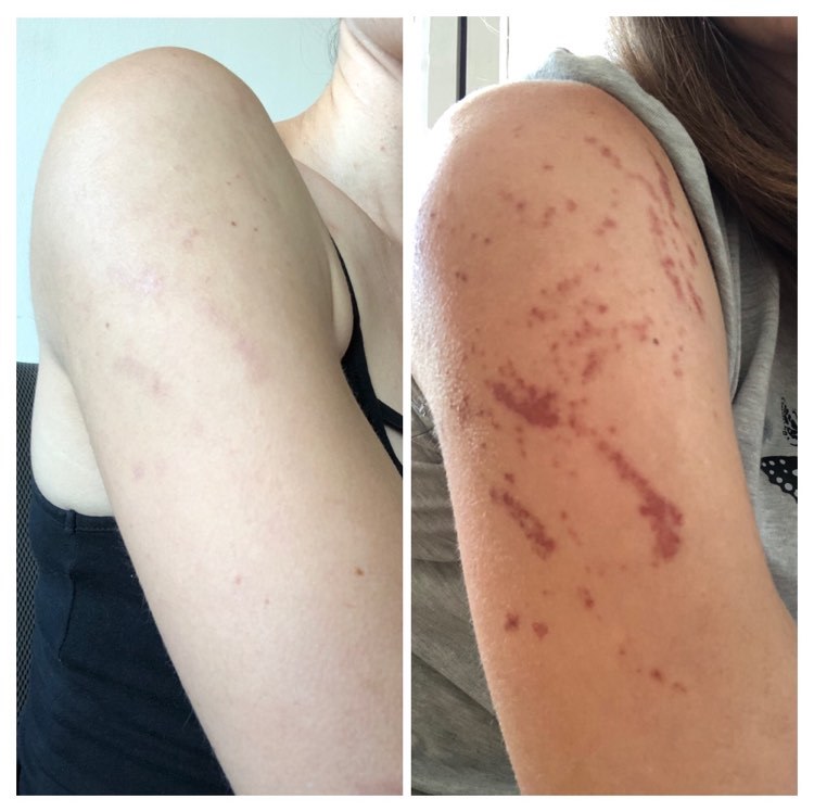 Cytovital a tick-a-tack pomocníci zahradníků