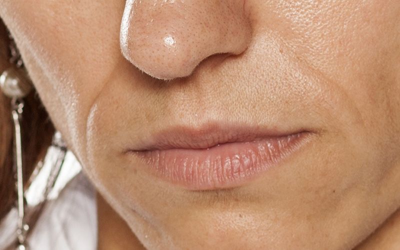 ageless-prima-dopo-01-prima-1a598331