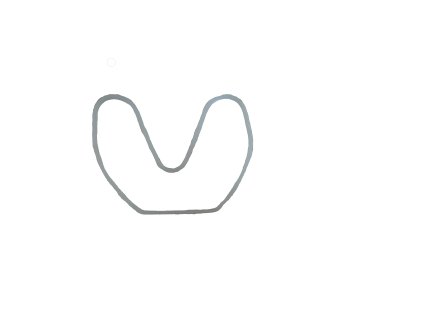 ND Schepach HC 52, HC 53, HC 100 DC, HC 120 DC - tesnenie hlavy (E3-4)