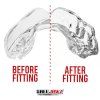 Mouth guard “Intro” (Farba Transparent, Skupina Junior)