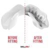 Mouth guard “Intro” (Farba Transparent, Skupina Junior)