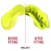 Mouth guard “Intro” (Farba Transparent, Skupina Junior)