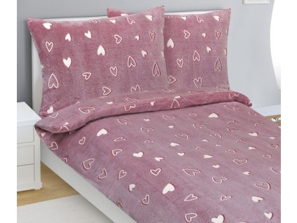 ZPOVLMIKROFL95294001 a1752657066