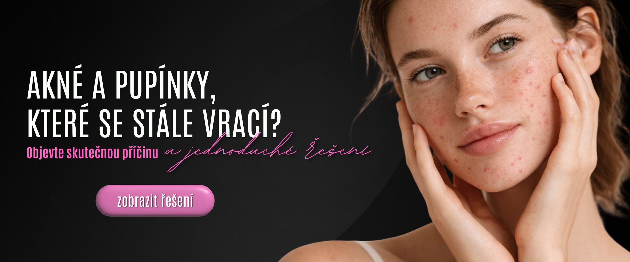 akne a pupínky, které se vrací?