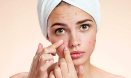 Can CBD Be Suitable for Skincare?