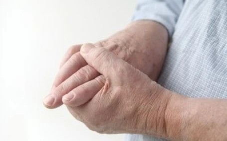 CBD for Arthritis