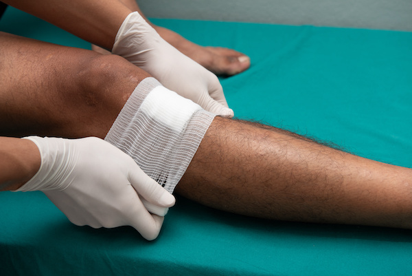 Does hemp ointment also help with leg ulcers?