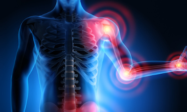 The Role of CBD in Treatment of Osteoarthritis