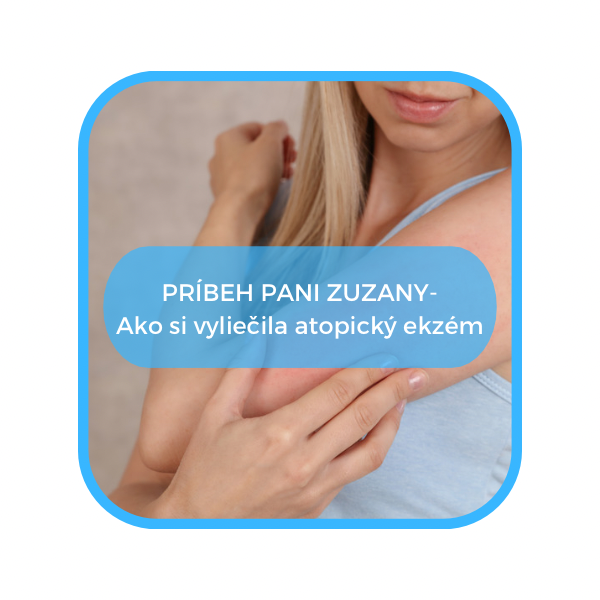 Príbeh pani Zuzany - Ako si vyliečila atopický ekzém