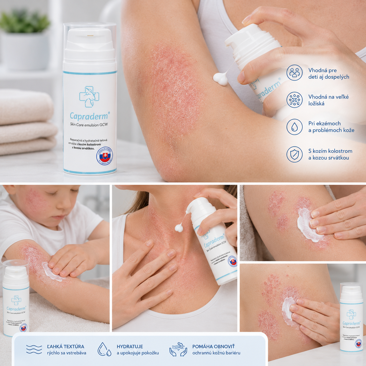 CAPRADERM Skin Care emulsion GCW pri starostlivosti o problematickú pokožku