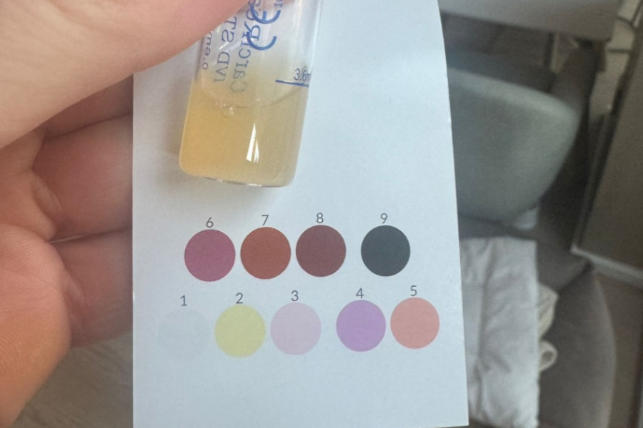 Gebrauchsanweisung für den Carci Reagent® Test