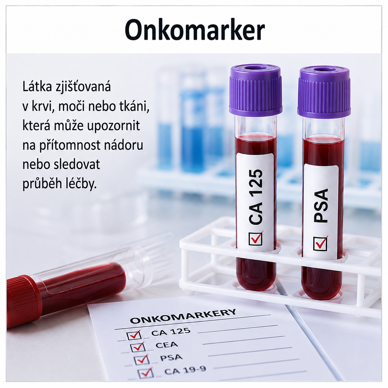 Onkomarker