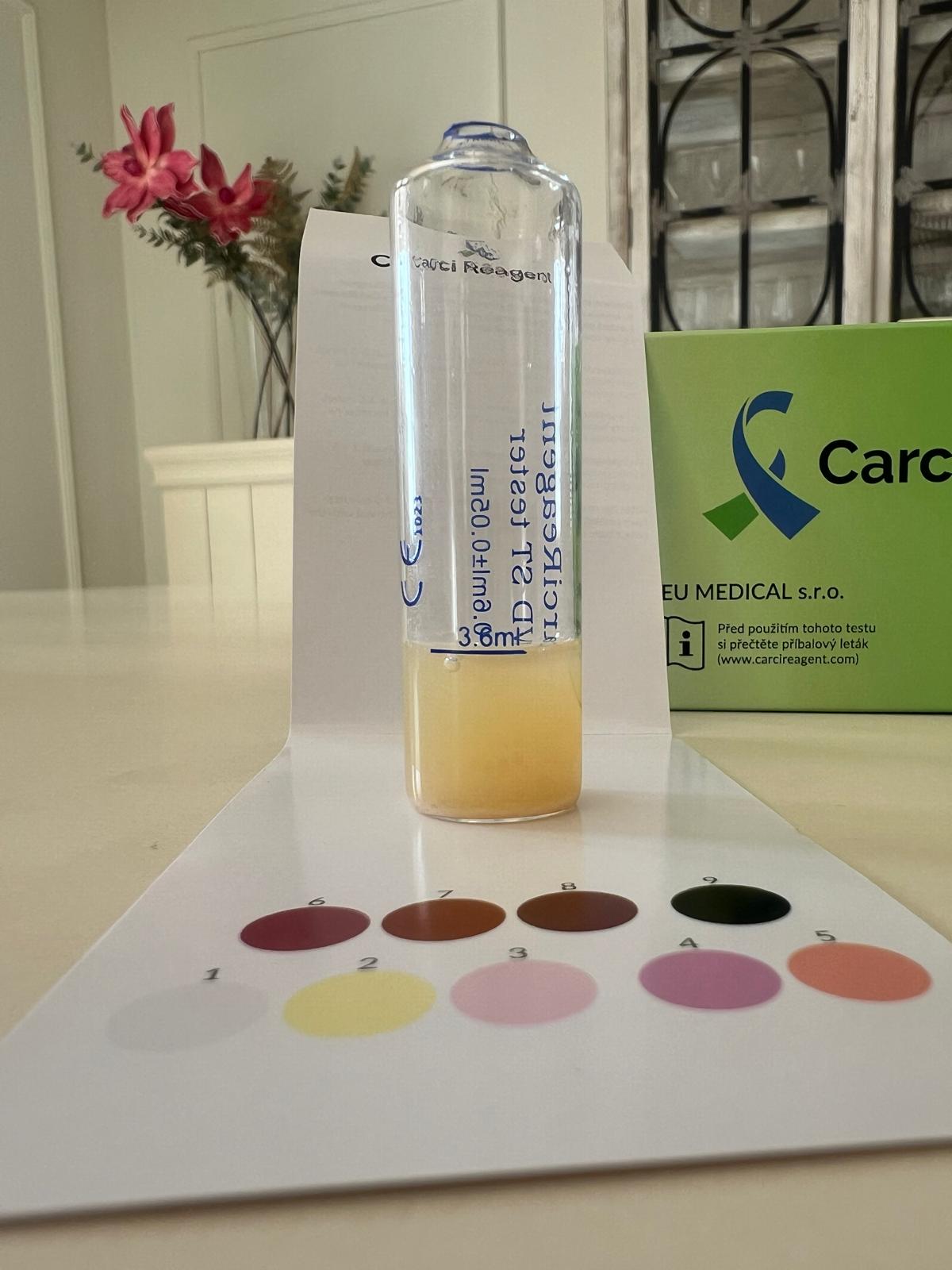 Porovnání vzorku se stupnicí Carci Reagent