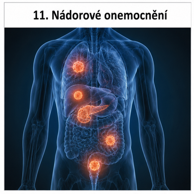 11-nadorove-onemocneni