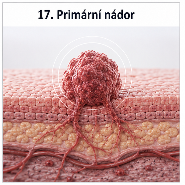 17-primarni-nador