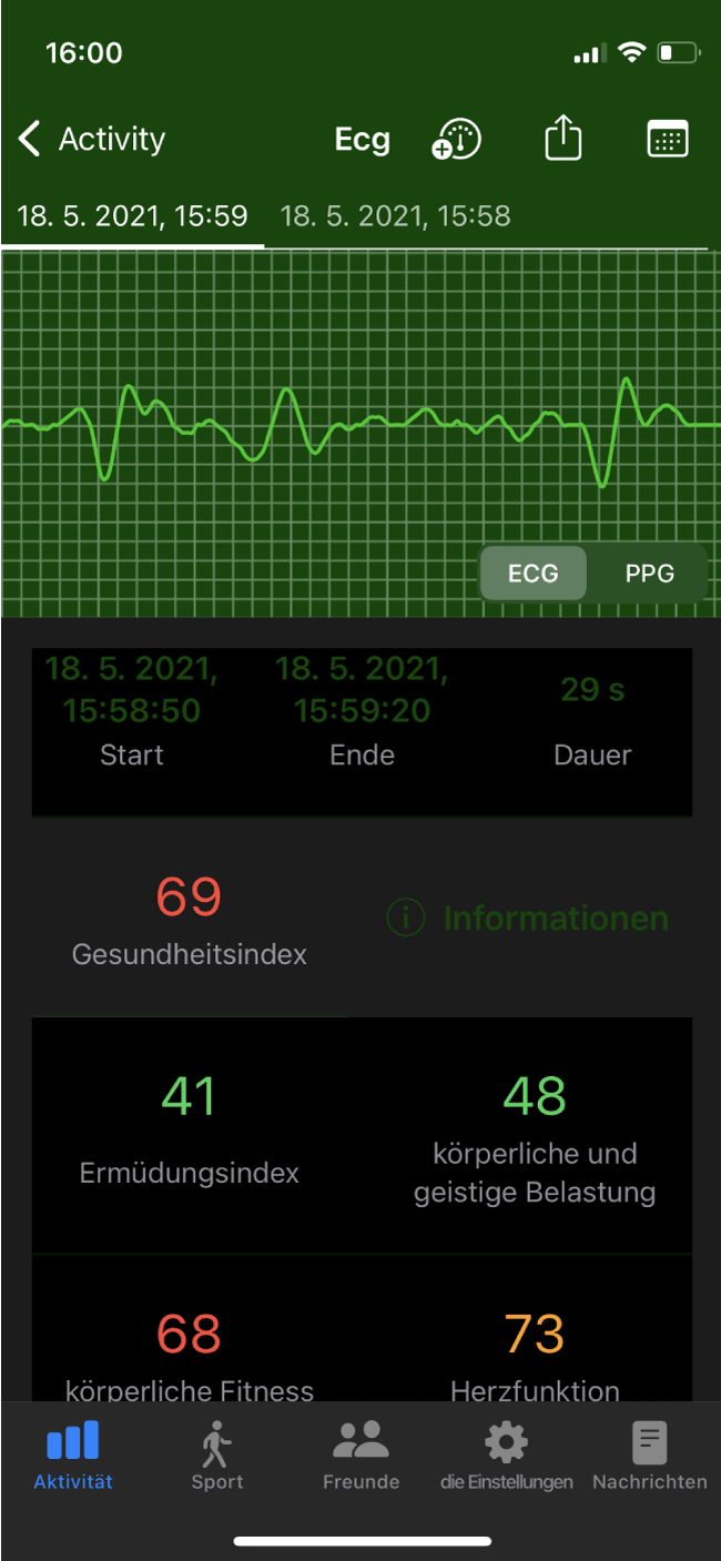 EKG-MESSUNG