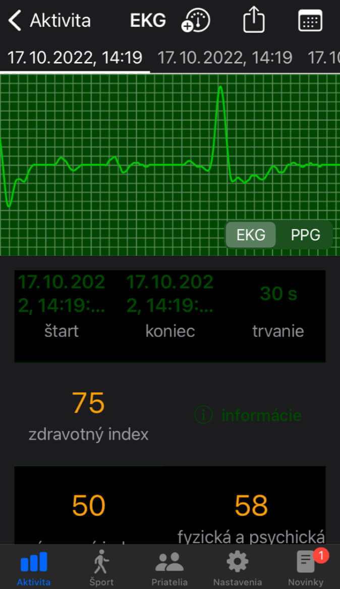 Měření EKG