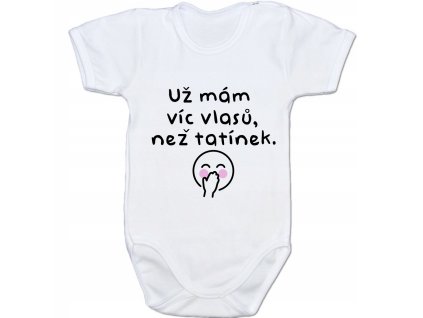 víc vlasů