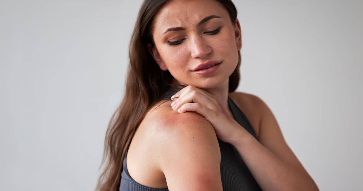 CBD a kožní potíže