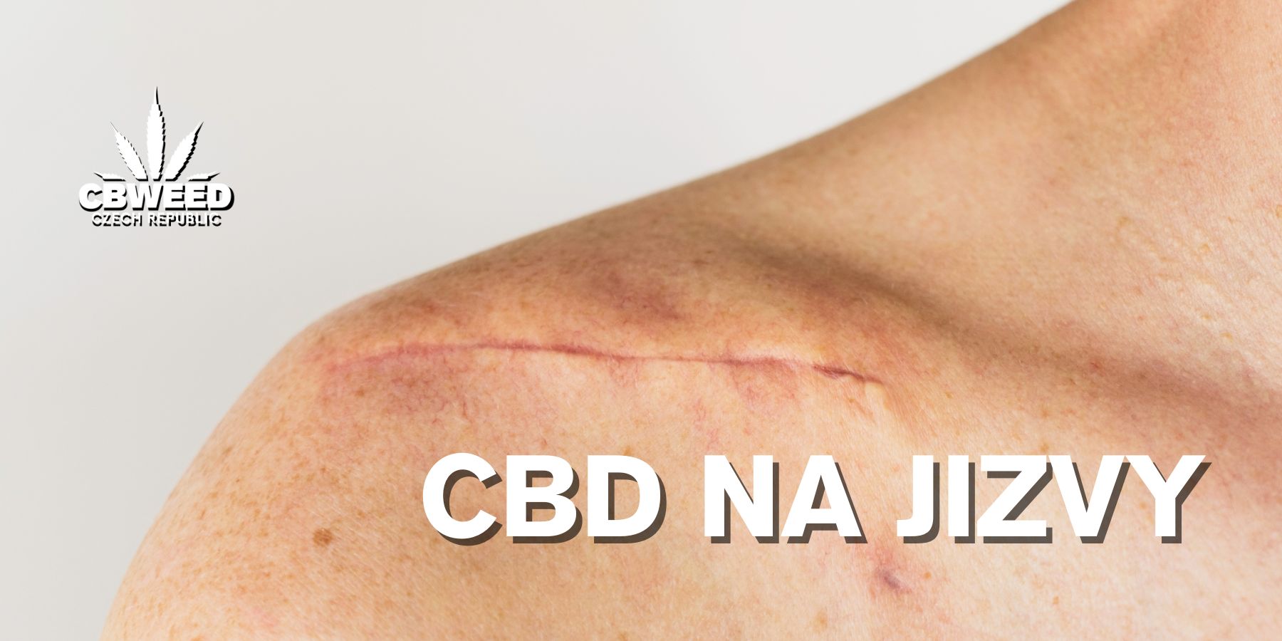 CBD a konopná kosmetika při léčbě jizev