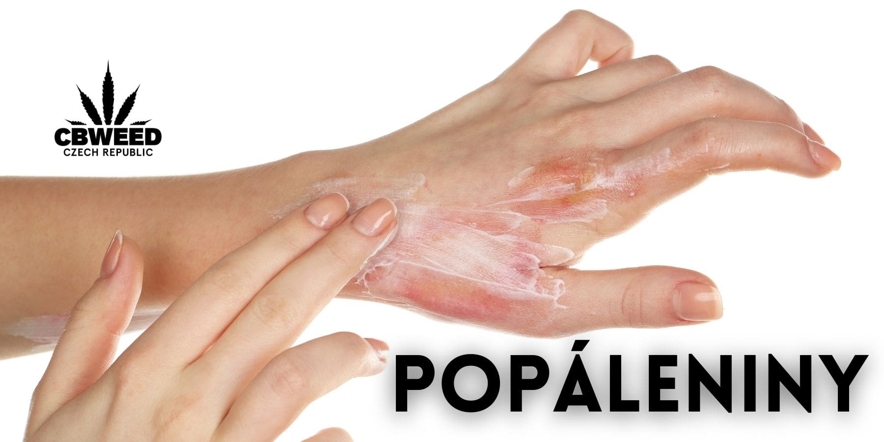 konopi-a-popaleniny