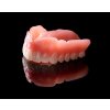 lab image lucitone digital ipn denture