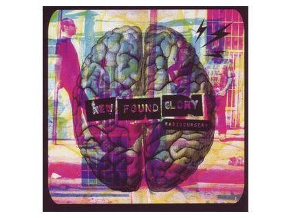 NEW FOUND GLORY - RADIOSURGERY (CD)