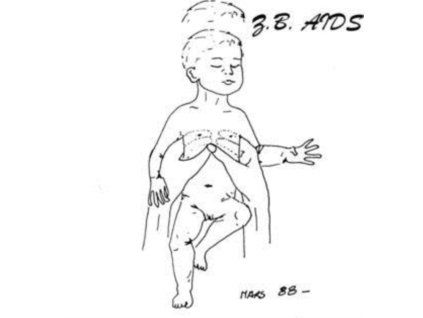 4102007 z b aids gestalt lp