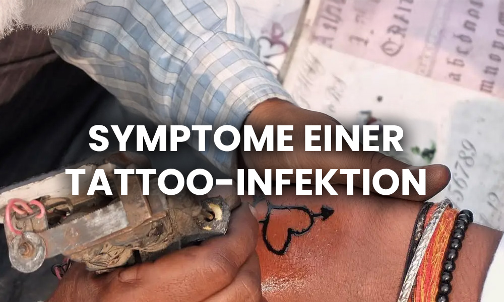 Symptome einer Tattoo-Infektion