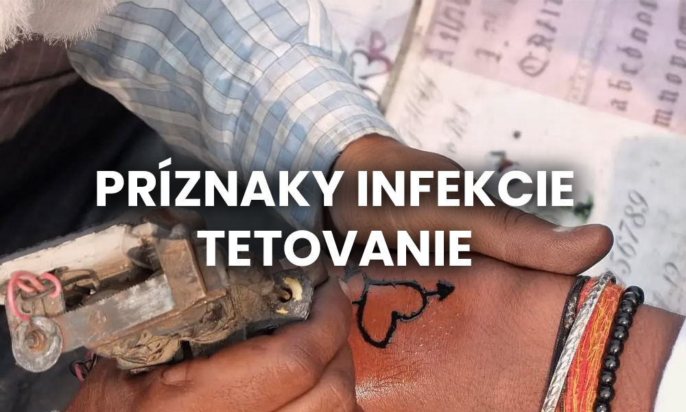 Príznaky infekcie tetovanie