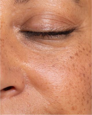 Oční okolí je nejtenčí oblastí obličeje… a často na něj při skincare zapomínáme, bez debat si zaslouží si pozornost. 🙏 Bez...