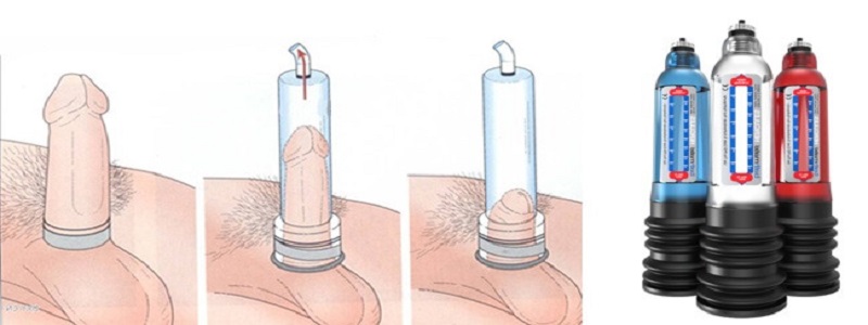 Vakuové pumpy - jakou vakuovou pumpu koupit?