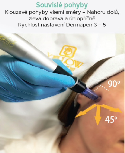 Derma pen souvislé pohyby