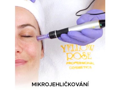 dermopen-dermapen-yellow-rose-charde-skoleni-mikro-jehlickovani