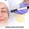 dermopen-dermapen-yellow-rose-charde-skoleni-mikro-jehlickovani